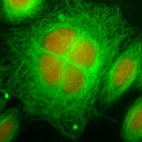 Cellules en trèfle. Département d'enseignement et de recherche de Biologie ENS Paris-Saclay
